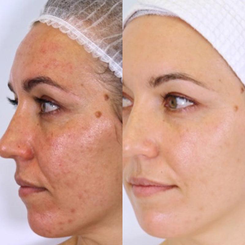 Vanessa Megan The Holy Trinity Daily Skin Care Routine - Gwinganna Lifestyle Retreat